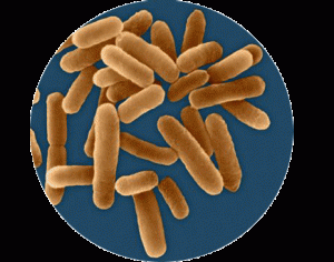 Hygiène de l'eau dans un ballon d'eau